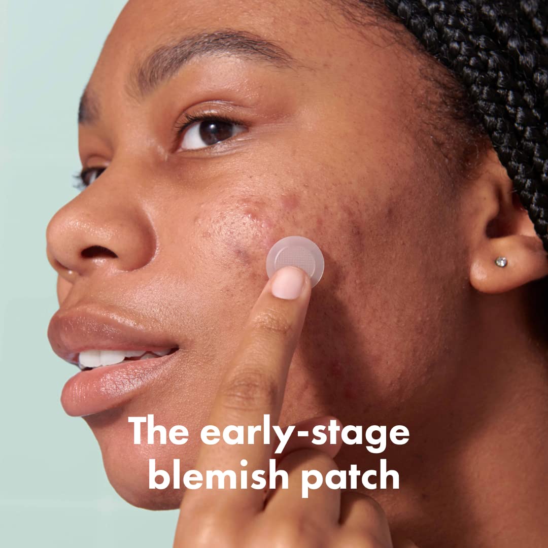 Mighty Patch Micropoint™ for Blemishes from Hero Cosmetics - Hydrocolloid Acne Spot Treatment Patch for Early Stage Zits and Hidden Pimples, 395 Micropoints (8 Patches)